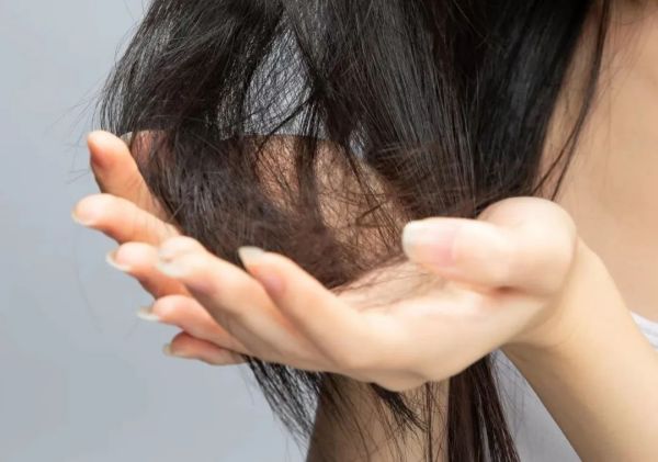 刘红艳 | 脱发原因有多种，对症下药就能让你发量翻倍再翻倍